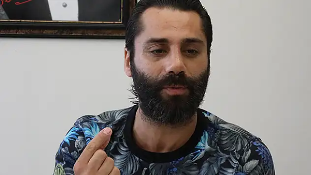 Survivor'dan sonraki ilk işi burnunu düzeltmek oldu