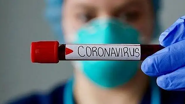Tablo ağırlaştı! Bilim Kurulu'ndan koronavirüs kararı: En az bir hafta yasak