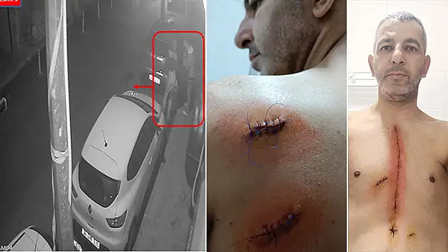 Tartışan çifte müdahale edince bıçaklandı: Kimseye yardım edemiyorum

