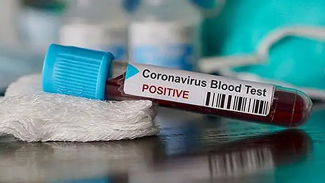 TBMM doktoru ve Kırklareli Valisi'nin koronavirüs test sonuçları açıklandı