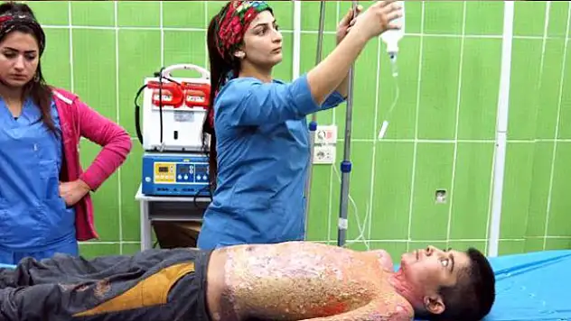 Terör örgütünün 'kimyasal silah' yalanı ortaya çıktı! Kazan ve tişörtü alev almış
