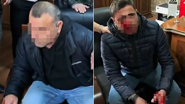 Trabzon'da veli okulda öğretmeni darp etti