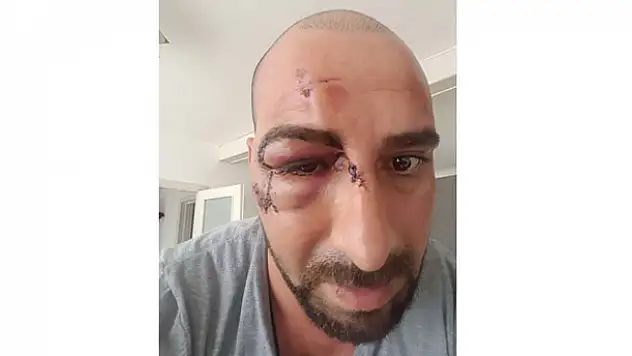 Türk vatandaşını 'Erdoğancı' diye darp etti