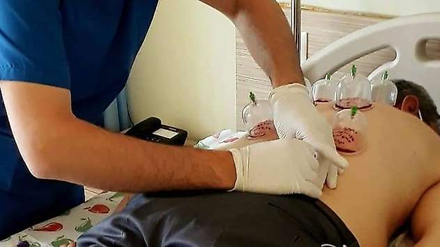 Uzmanlardan 'hacamat' uyarısı: Yanlış uygulamalar ömür boyu geçmeyen ağrılar oluşturuyor