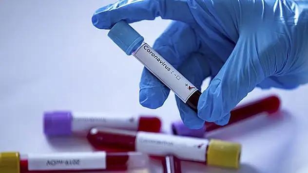 Vaka sayısı ve can kaybı kaç oldu? 26 Temmuz koronavirüs tablosu