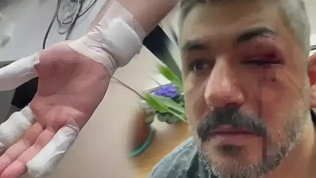 Veliyi hastanelik eden kavga! 'Sizin veremediğiniz eğitimi, ben döverek veriyorum'
