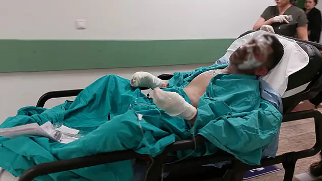 Yaktığı ateşe tiner döken genç ağır yaralandı