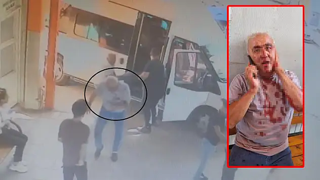 Yolcu, minibüs şoförünün kulağını ısırarak koparttı
