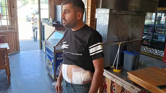 Yoldan geçen kadına laf atanlara tepki gösterince karnından bıçaklandı