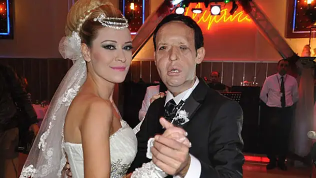 Yüz nakli olan Recep Sert, kız babası olacak