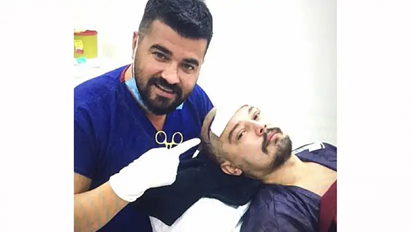 Arda Kural ilk adımı attı, saç ektirdi