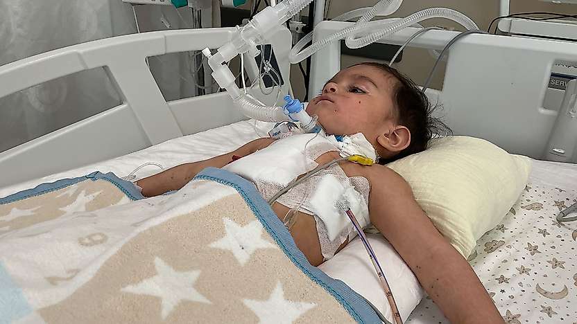 Konya'da mucize kurtuluş! Ceviz yutan bebek ölümden döndü