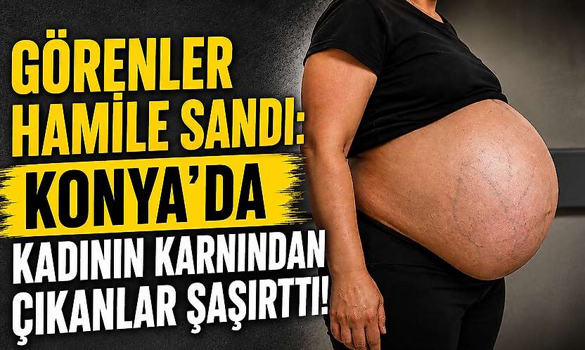 Görenler hamile sandı: Konya'da kadının karnından çıkanlar şaşırttı