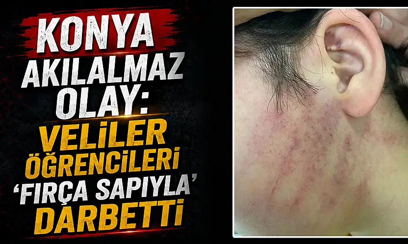 Konya akılalmaz olay: Veliler öğrencileri 'fırça sapıyla' darbetti