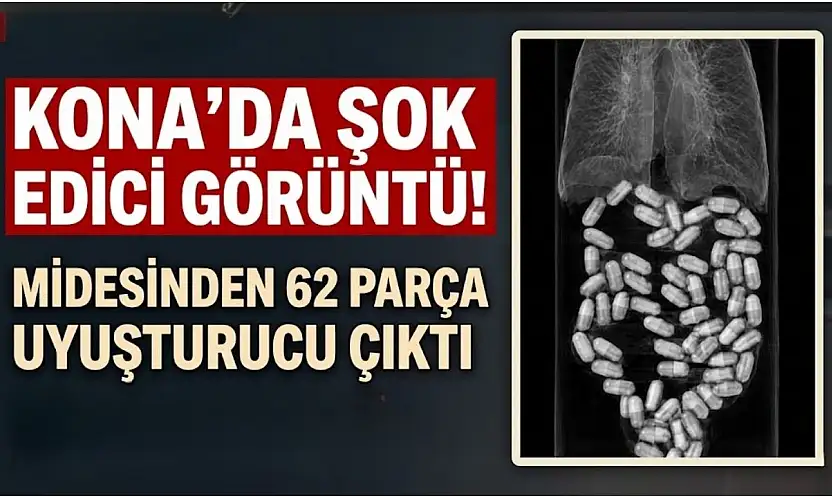 Konya'da midesinden 62 parça uyuşturucu çıktı