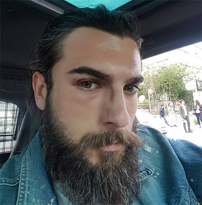 dirilis-ertugrul-dizisinin-turgut-alpi-sette-kaza-gecirdi-2