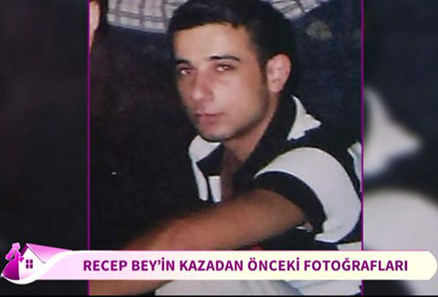 yuz-nakli-olan-recep-sertin-kazadan-onceki-hali-2